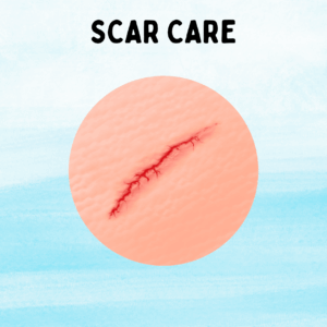 Scar Care
