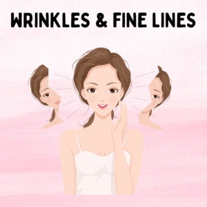 Wrinkles & Fine Lines